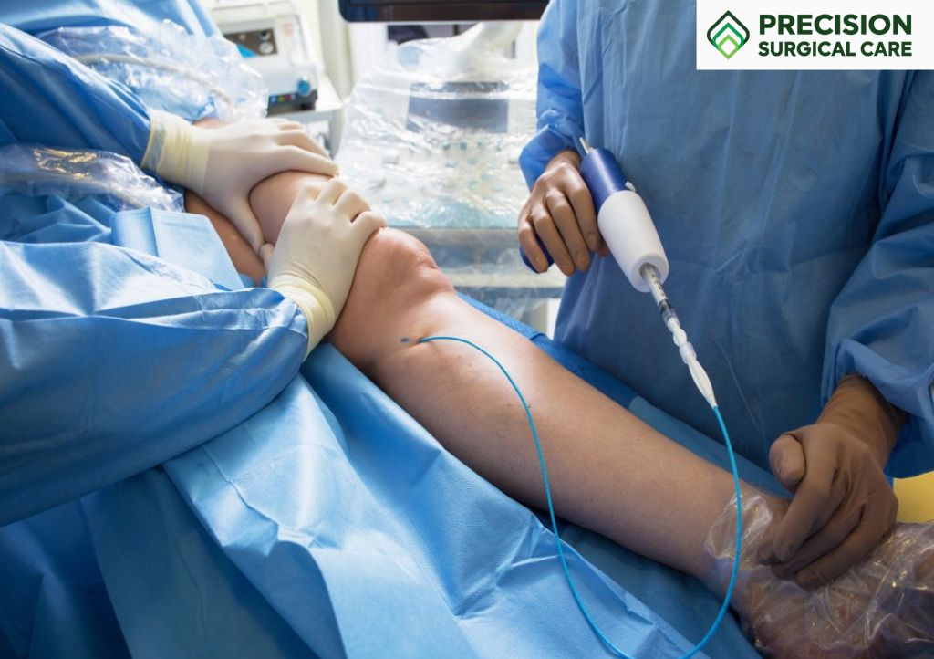 Varicose Vein Treatment in Coimbatore
